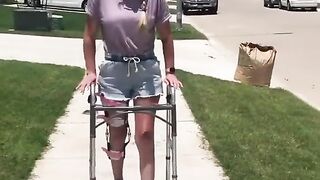 Pretty Lady in a Leg Brace