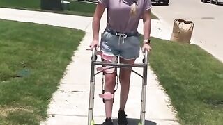 Pretty Lady in a Leg Brace