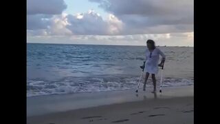 Polio Shortleg Crutching on the Beach