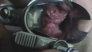 close up speculum and internal veiw of squirting