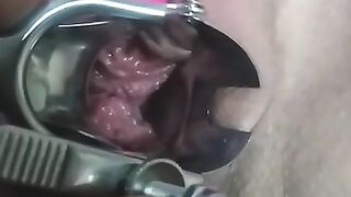 close up speculum and internal veiw of squirting