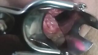 close up speculum and internal veiw of squirting