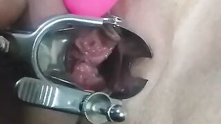 close up speculum and internal veiw of squirting